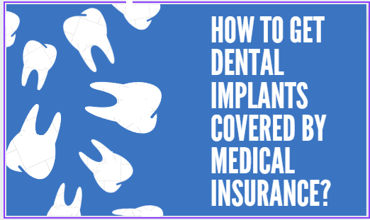 image of How to get dental implants covered by medical insurance